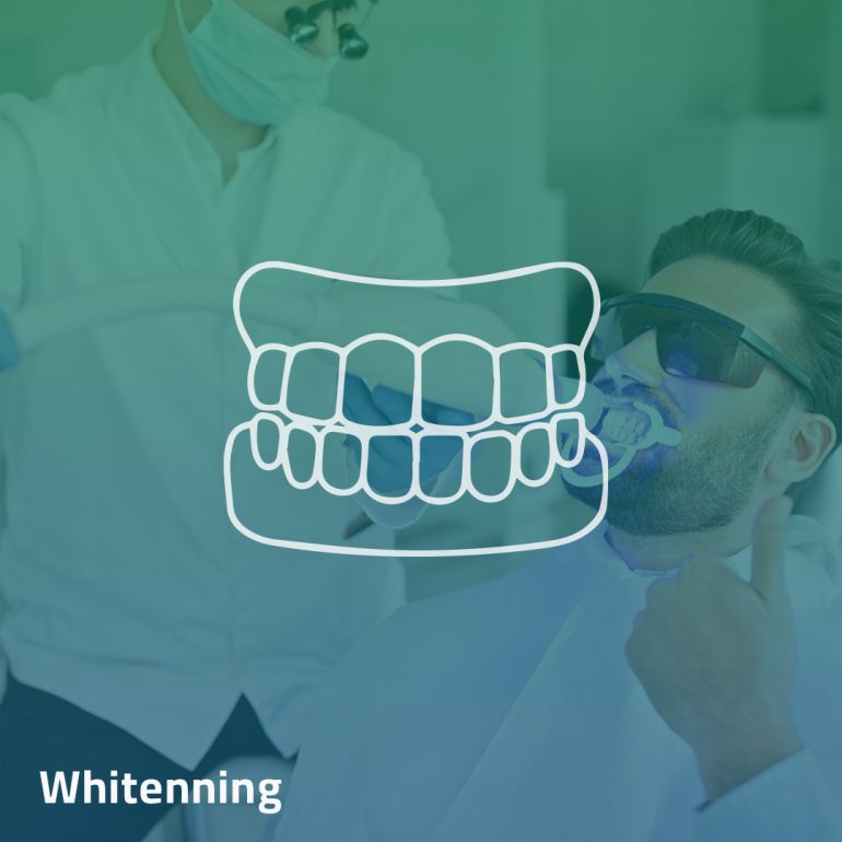 Whitening - Clinica Joina