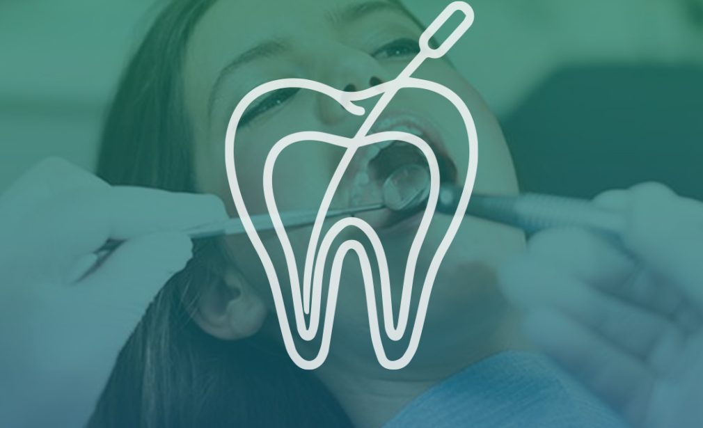Root Canal Treatment - Clinica Joina