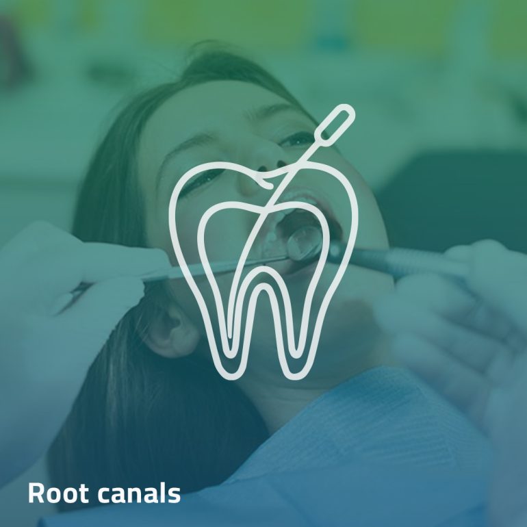 Root Canal Treatment - Clinica Joina