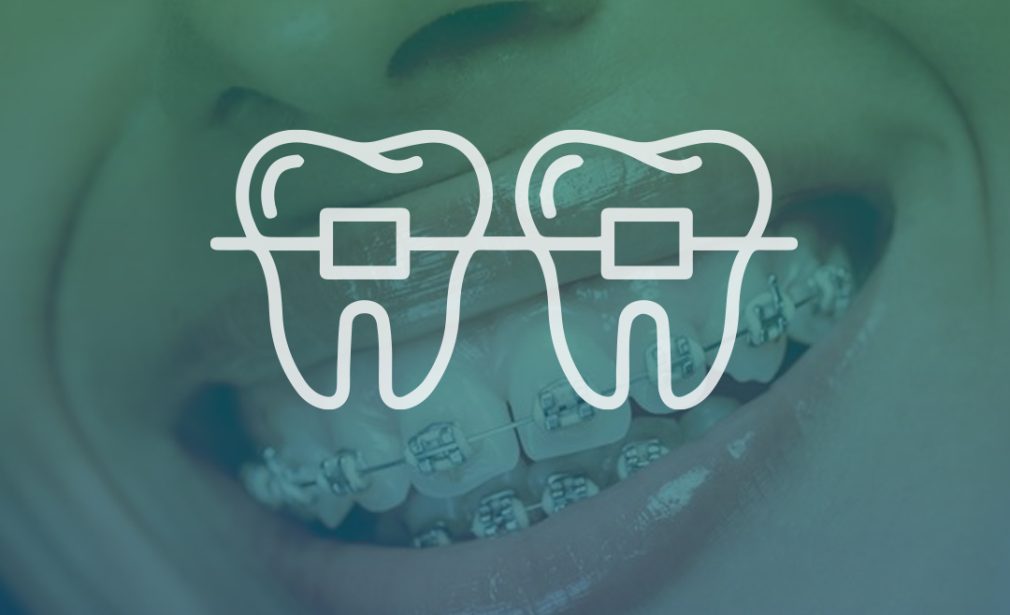 Orthodontics - Clinica Joina