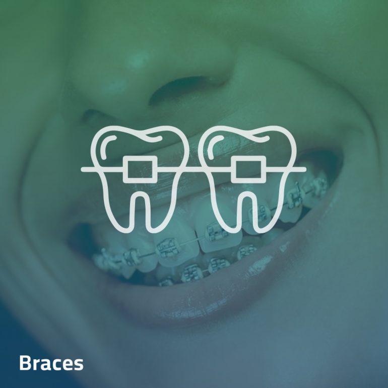 Orthodontics - Clinica Joina