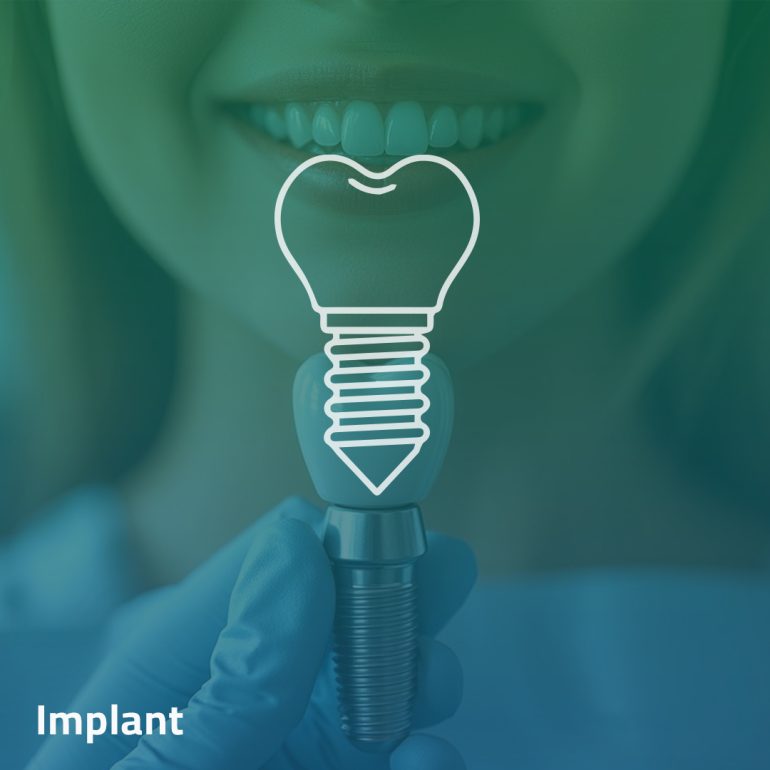 Implant - Clinica Joina