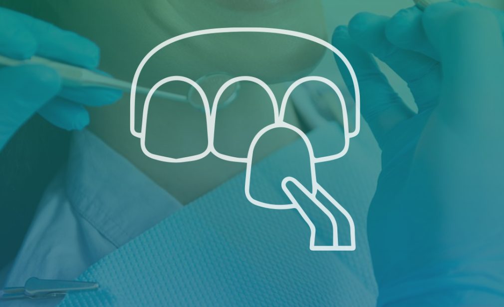 Veneers - Clinica Joina