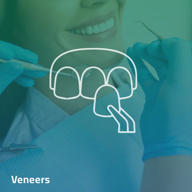 Veneers - Clinica Joina