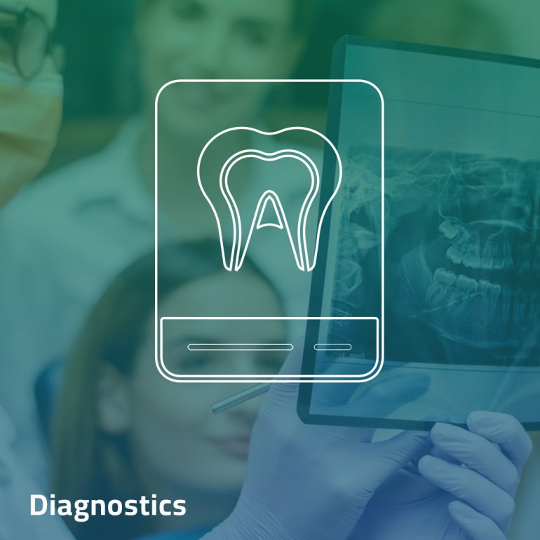 Crowns and Bridges - Clinica Joina